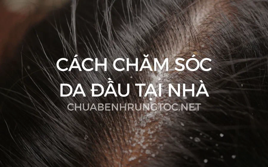 Chăm sóc da đầu tại nhà hiệu quả | Cẩm nang từ A đến Z