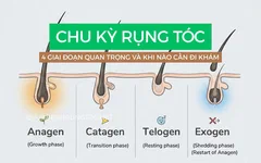 4 Giai đoạn trong chu kỳ rụng tóc mọi chị em nên biết