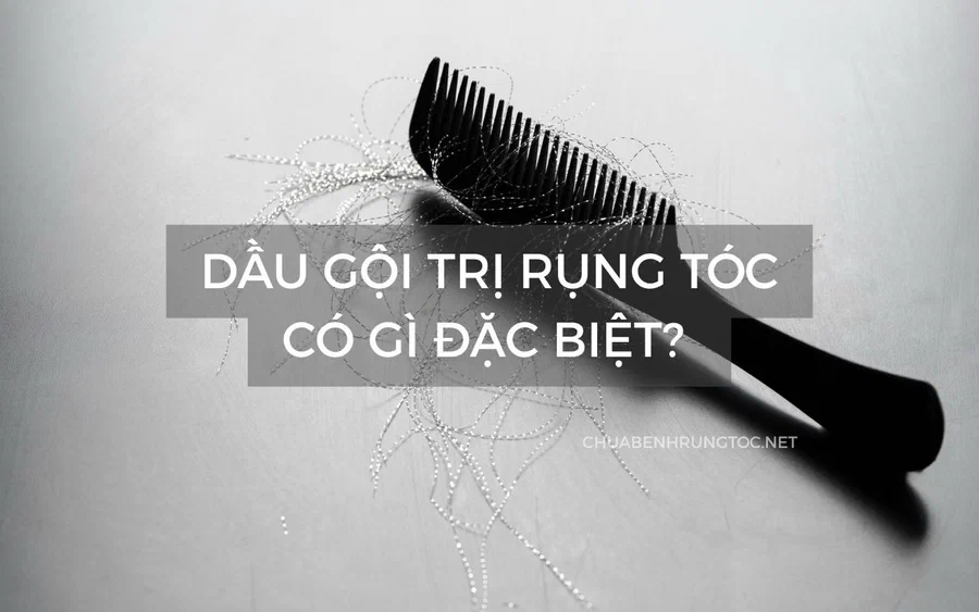 Dầu gội trị rụng tóc có gì đặc biệt? 10 loại phổ biến và sự thật về hiệu quả