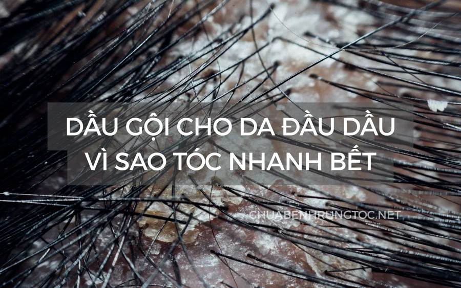 Dầu gội cho da đầu dầu: vì sao tóc nhanh bết và 11 loại đáng cân nhắc