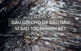 Dầu gội cho da đầu dầu: vì sao tóc nhanh bết và 11 loại đáng cân nhắc