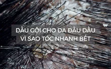 Dầu gội cho da đầu dầu: vì sao tóc nhanh bết và 11 loại đáng cân nhắc