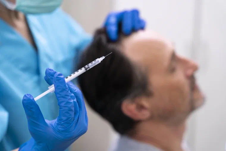 Tiêm corticosteroid vào vùng da đầu bị rụng tóc từng mảng