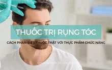 Các loại thuốc trị rụng tóc nổi tiếng nhất hiện nay | Tổng hợp mới nhất 2026