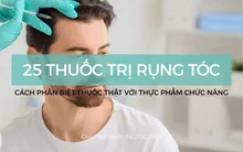 Thuốc trị rụng tóc: 25 sản phẩm phổ biến và cách phân biệt thuốc thật với thực phẩm chức năng